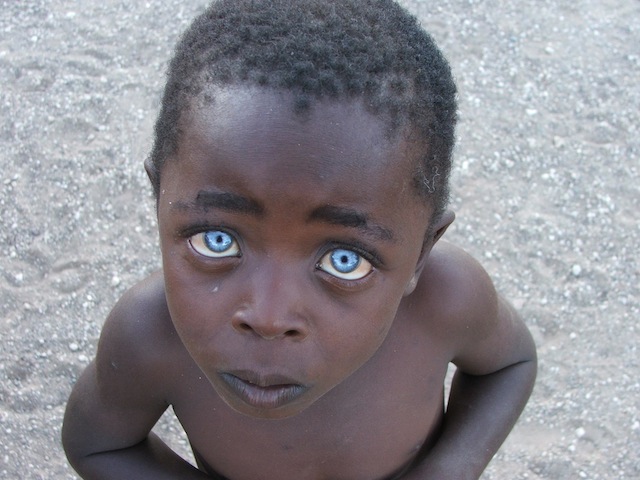 Scientists Shocking Discovery About Black Skin Melanesian Blonde Hair Blue  Eyes 